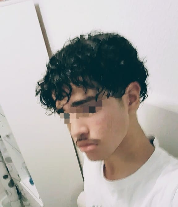 Turmeric Honey and Kojic Acid Soap