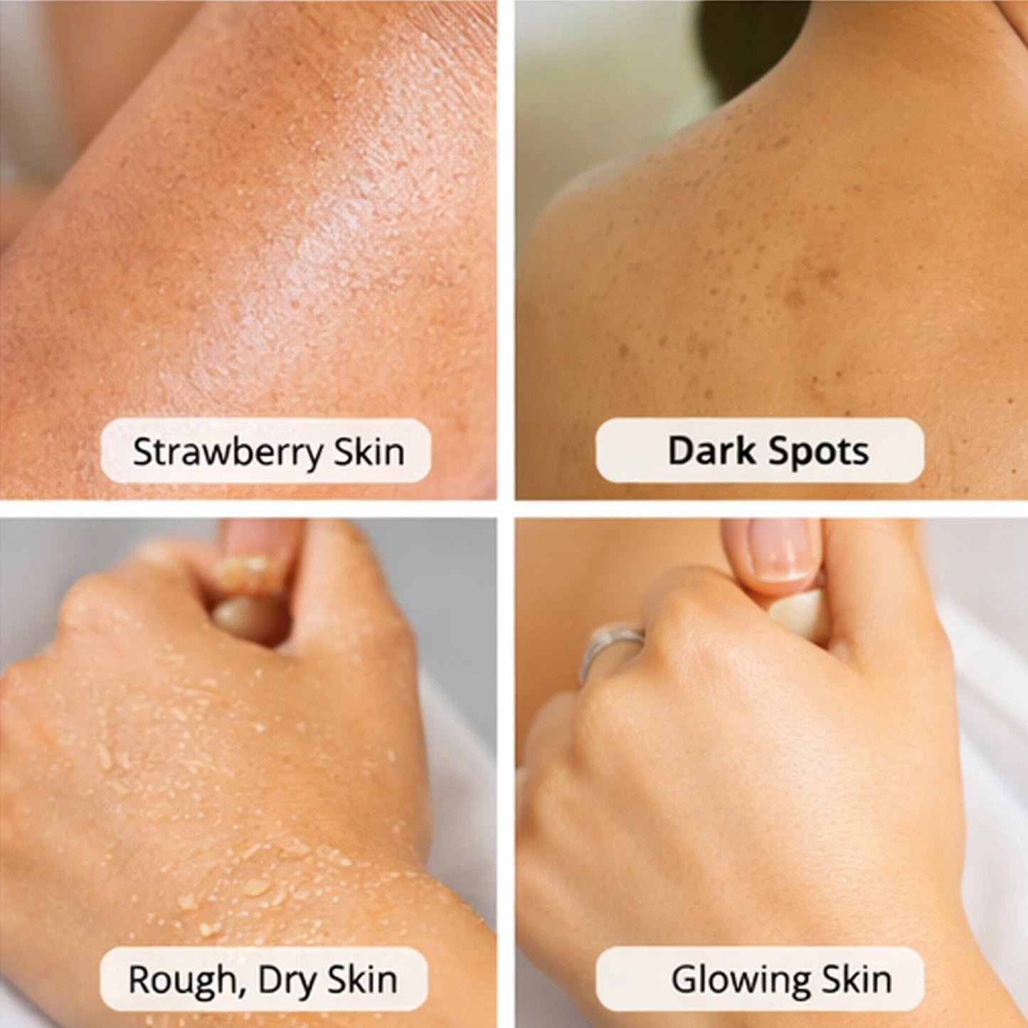 SparkGlow Clear Skin Body Scrub - Turmeric & Licorice Root for Acne & Dark Spots